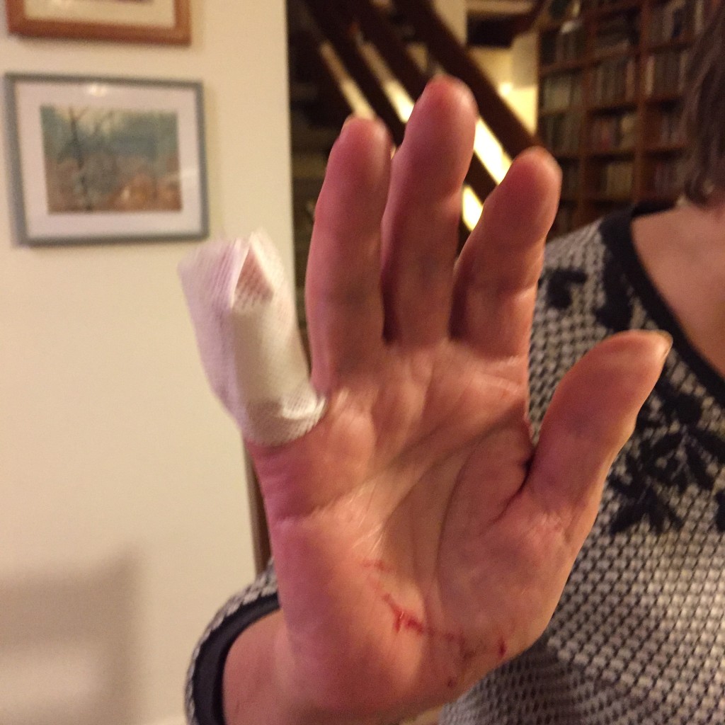 Hand up anyone who hurt herself.